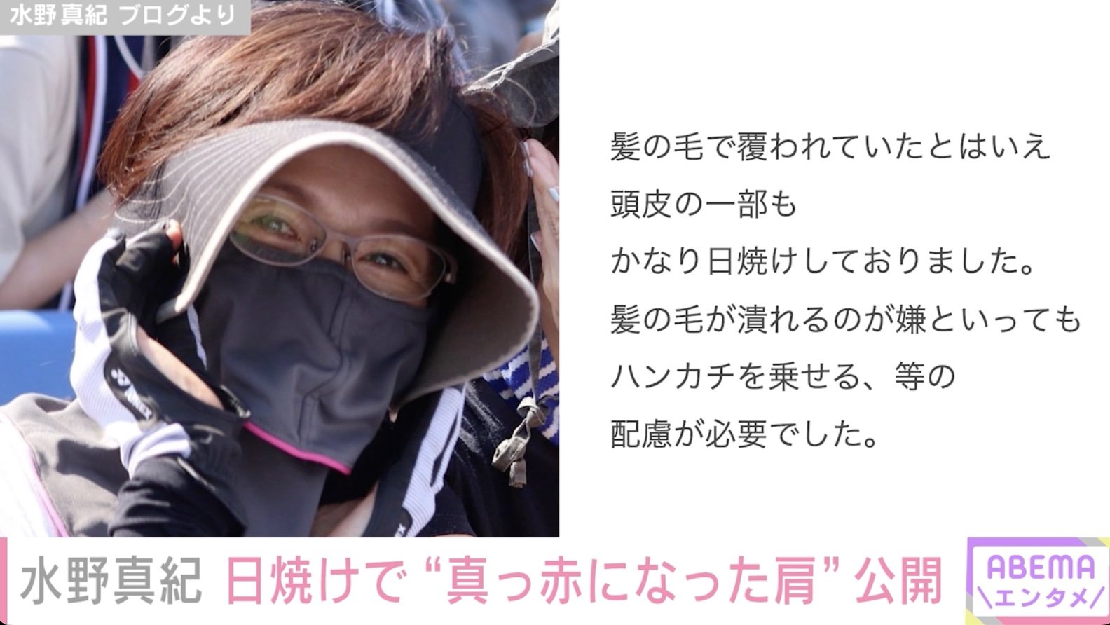 写真・画像】水野真紀、日焼けで真っ赤になった体を公開「痛々しい