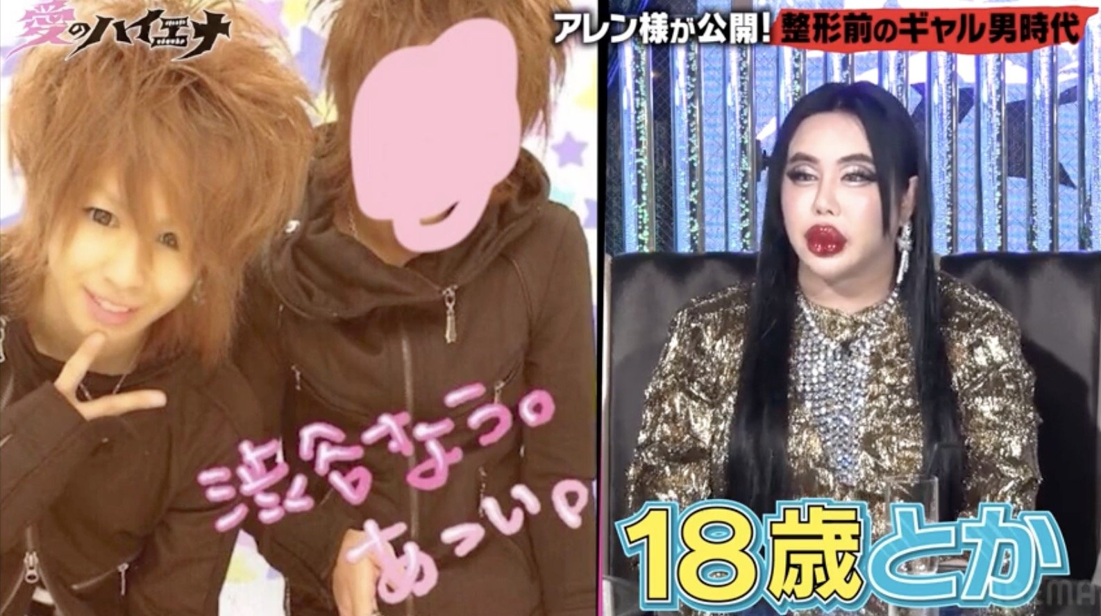 アレン様 昔