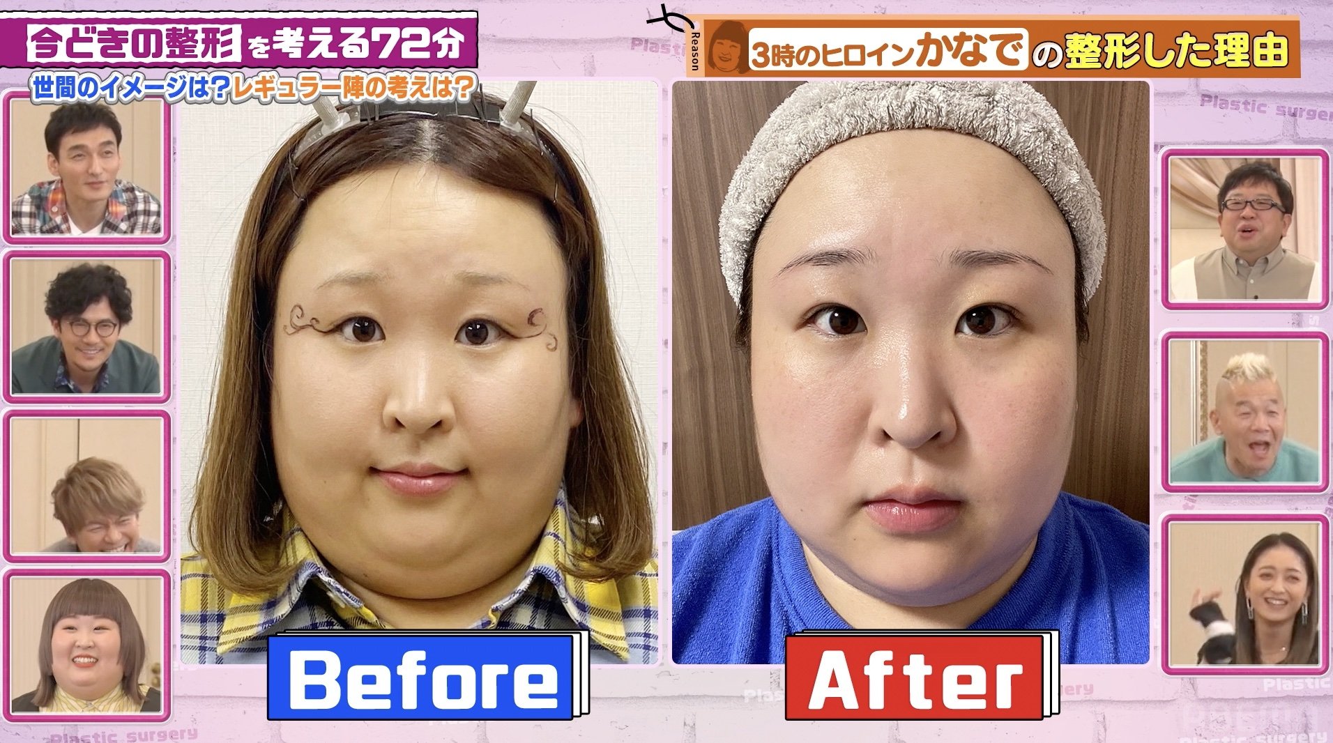 加護 亜依 整形