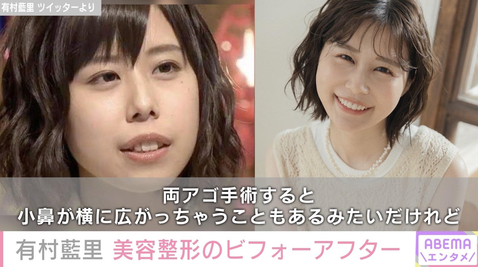 有 村 藍 里 整形 前