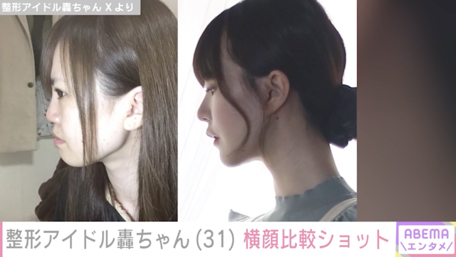 轟 ちゃん 本名