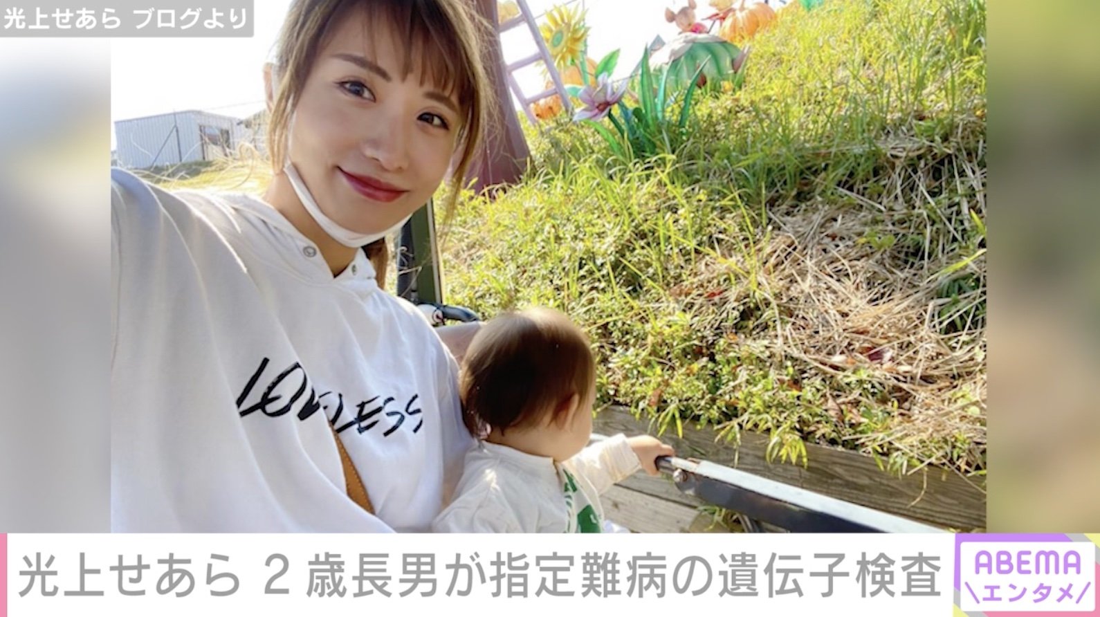 ヌーナン症候群芸能人