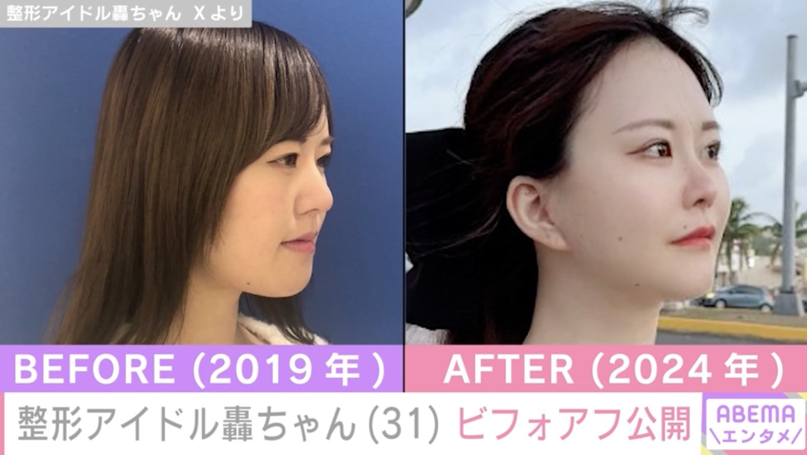 整形 アイドル 轟 ちゃん 整形 前