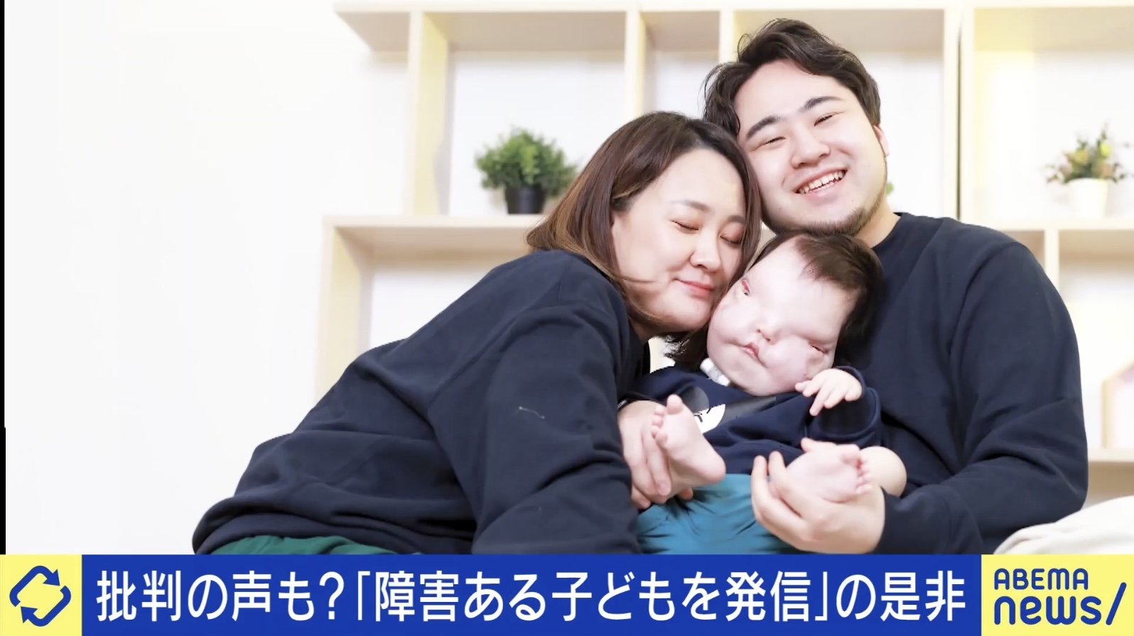 写真・画像】顔・頭蓋骨に形成異常を持つ息子を発信する両親の想い