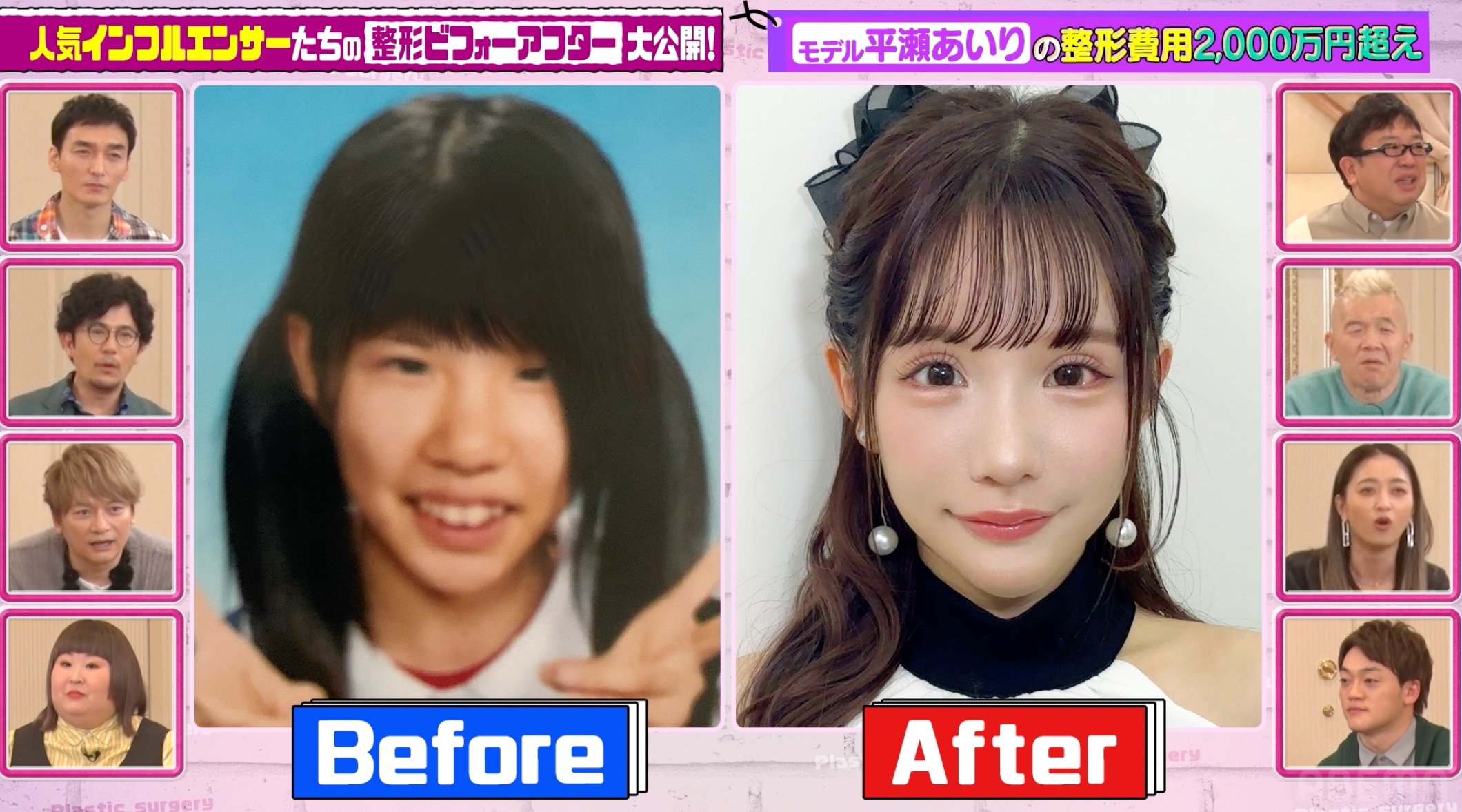 加護 亜依 整形